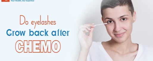Do Eyelashes Grow Back after Chemo