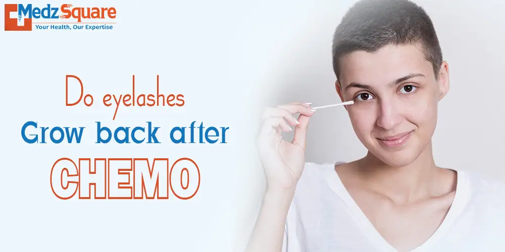 Do Eyelashes Grow Back after Chemo
