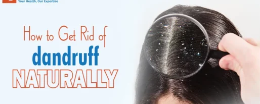 How to Get Rid of Dandruff Naturally