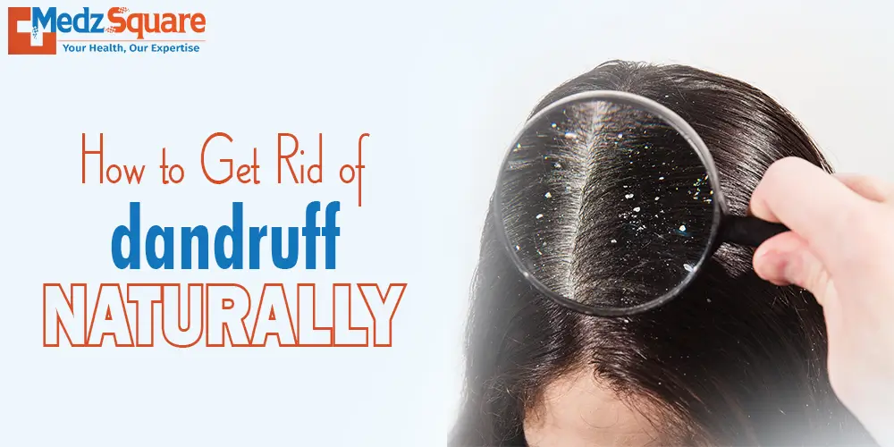 How to Get Rid of Dandruff Naturally