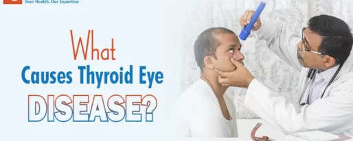 What causes Thyroid Eyе Disеasе?