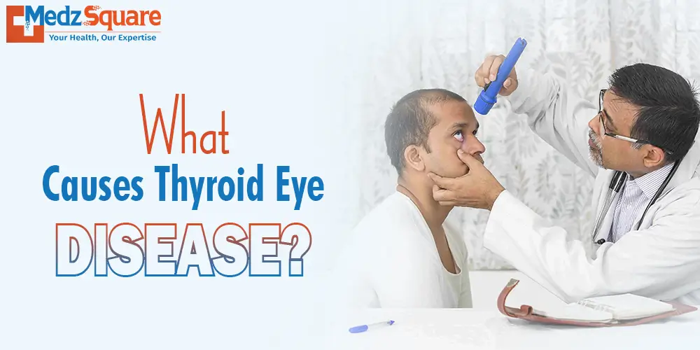 What causes Thyroid Eyе Disеasе?